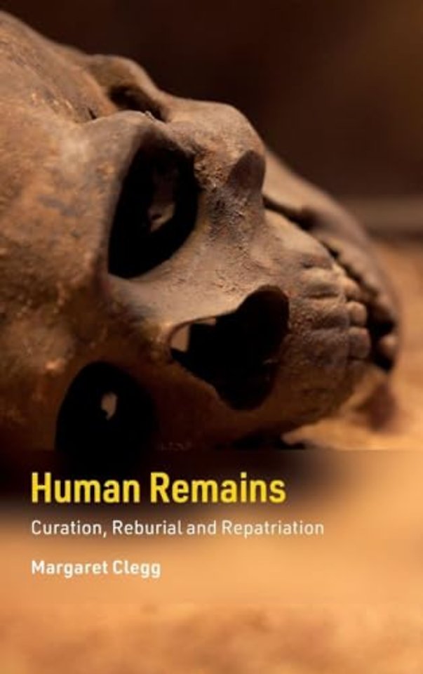 Human Remains