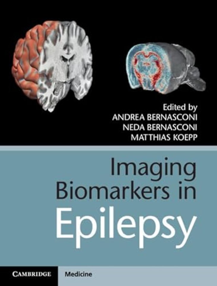 Imaging Biomarkers in Epilepsy