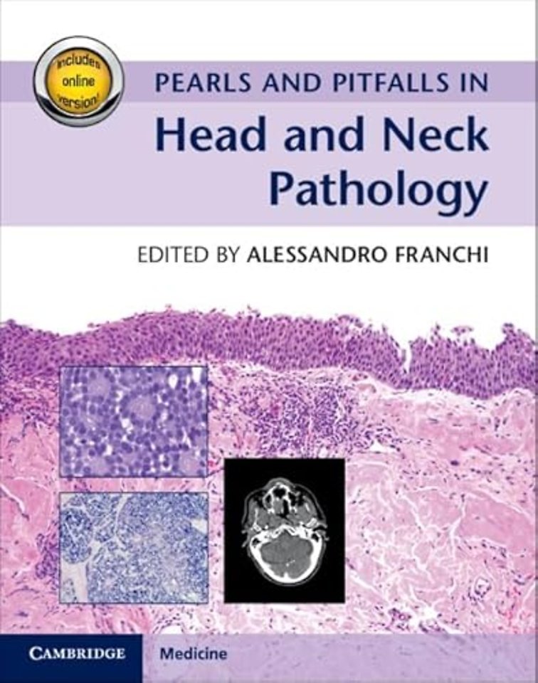 Pearls and Pitfalls in Head and Neck Pathology with Online Resource