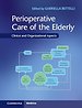 Perioperative Care of the Elderly Perioperative Care of the Elderly