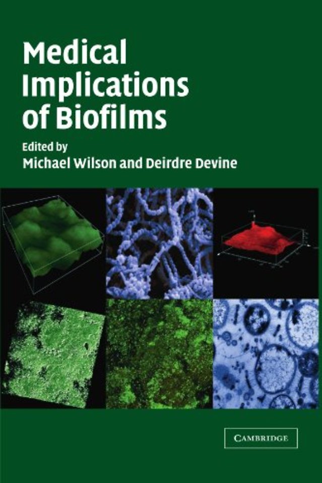Medical Implications of Biofilms