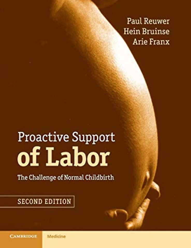 Proactive Support of Labor
