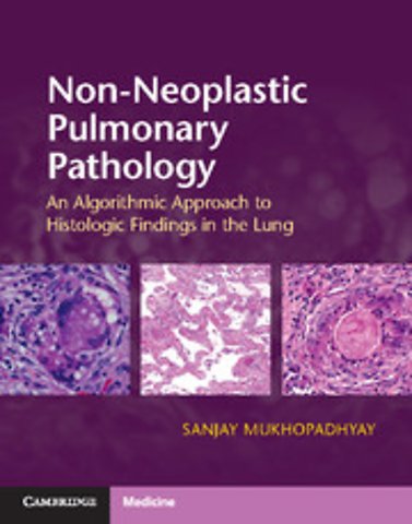 Non-Neoplastic Pulmonary Pathology with Online Resource