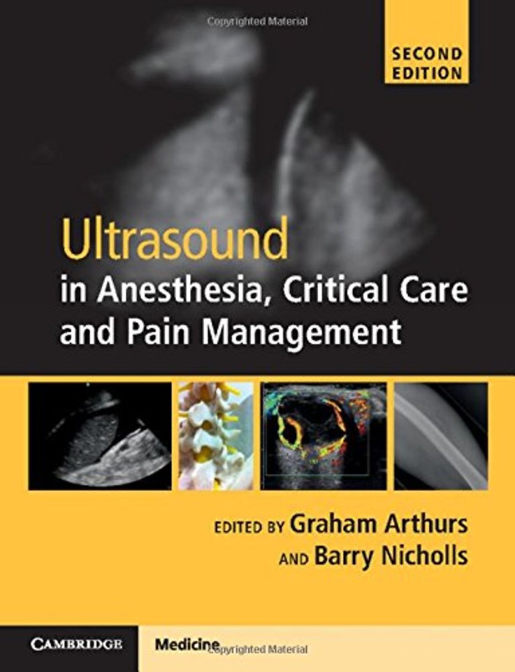 Ultrasound in Anesthesia, Critical Care and Pain Management with Online Resource