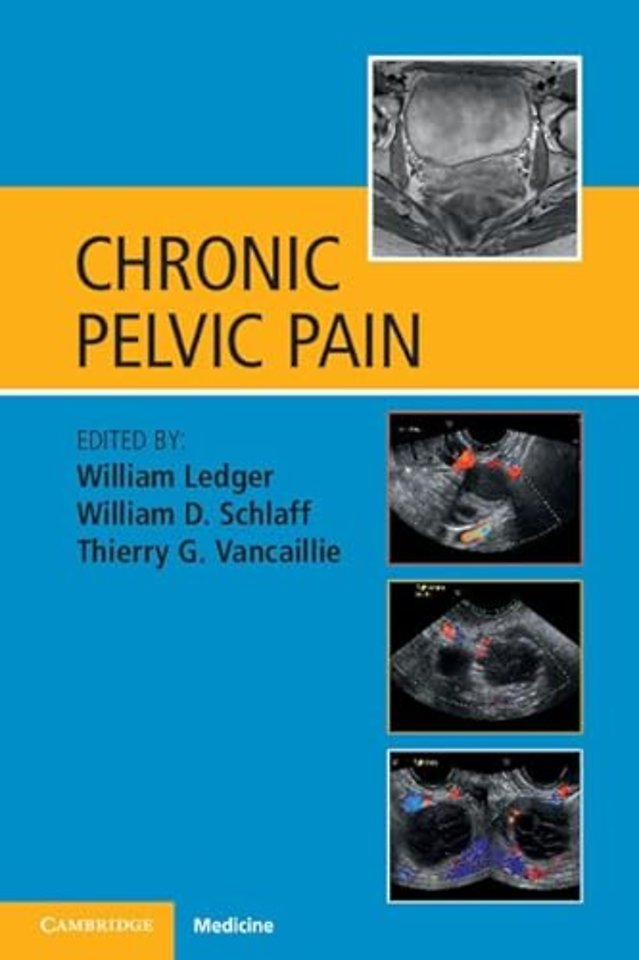Chronic Pelvic Pain