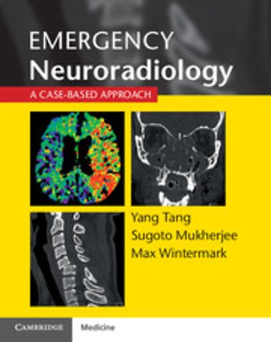 Emergency Neuroradiology