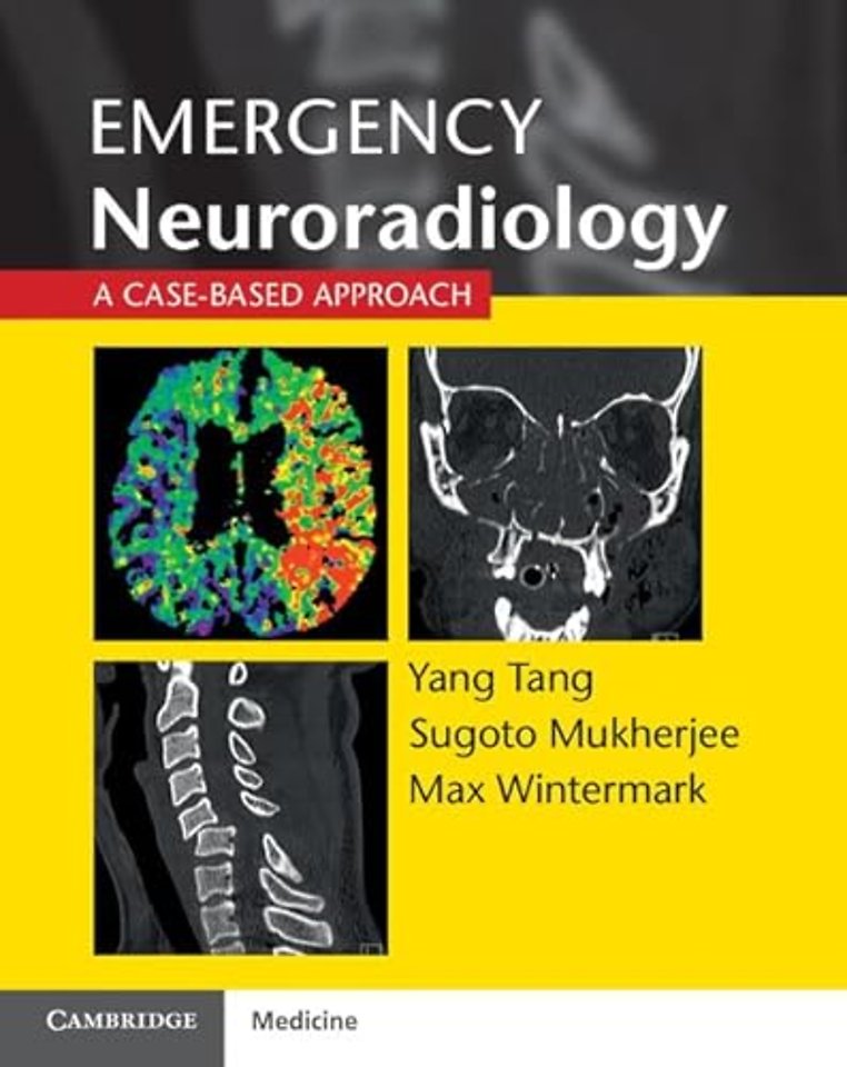 Emergency Neuroradiology
