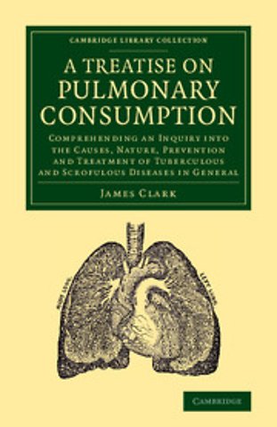 A Treatise on Pulmonary Consumption