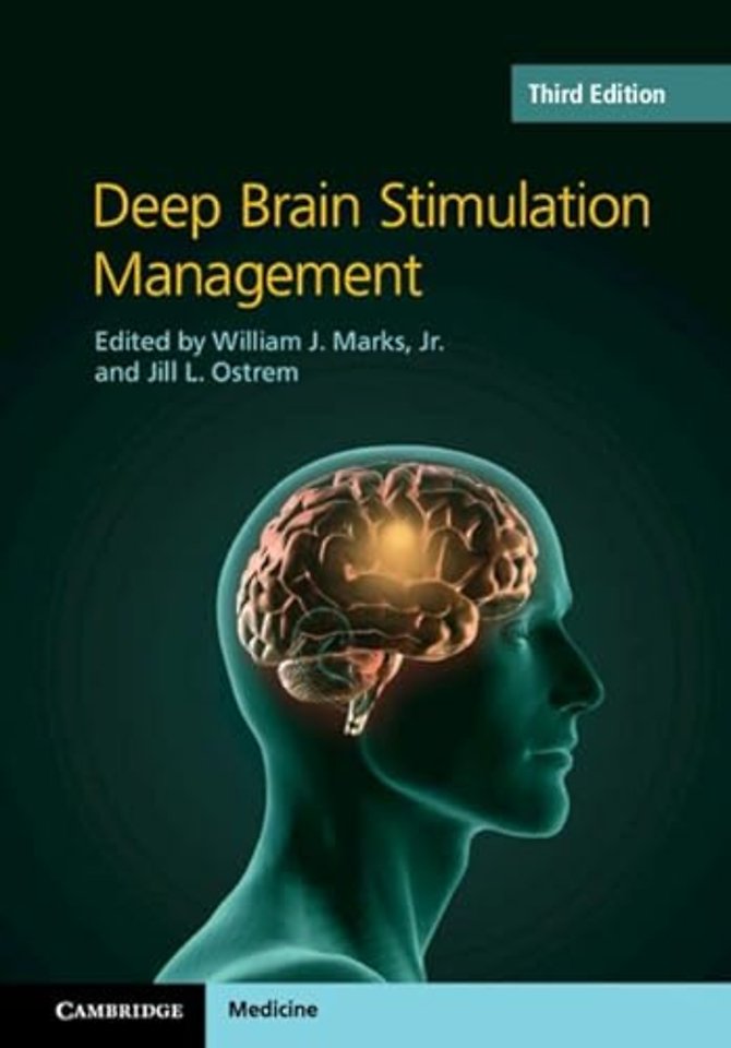 Deep Brain Stimulation Management