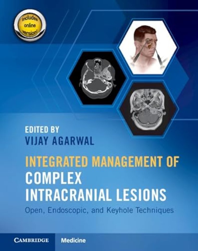 Integrated Management of Complex Intracranial Lesions Hardback Set and Static Online Product