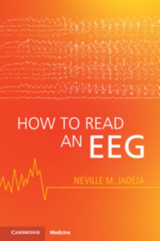 How to Read an EEG