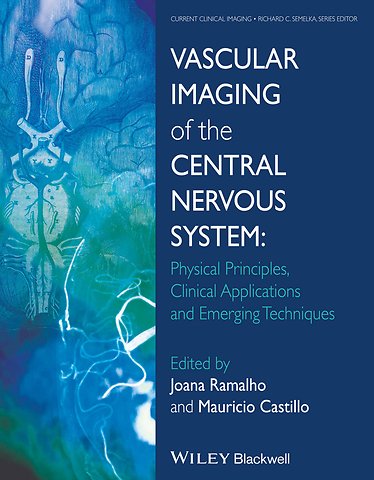 Vascular Imaging of the Central Nervous System – Physical Principles, Clinical Applications, and Emergency Techniques
