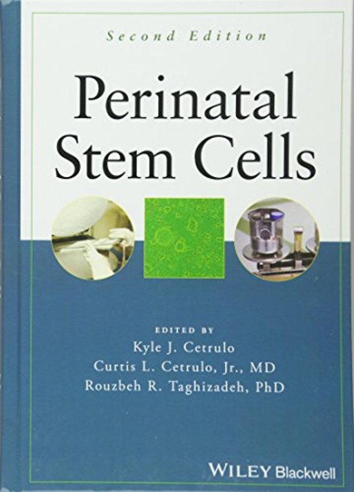 Perinatal Stem Cells