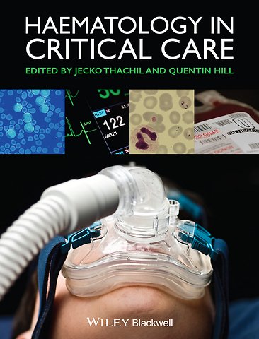 Haematology in Critical Care – A Practical Handbook
