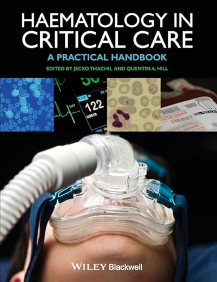 Haematology in Critical Care – A Practical Handbook