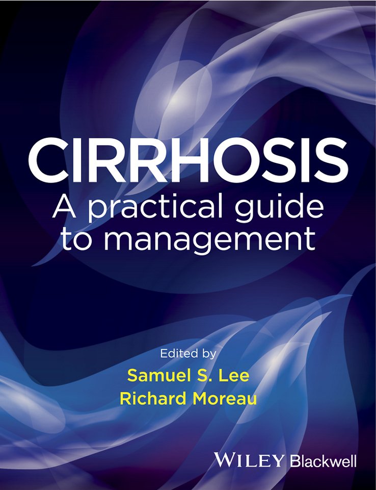 Cirrhosis – A practical guide to management