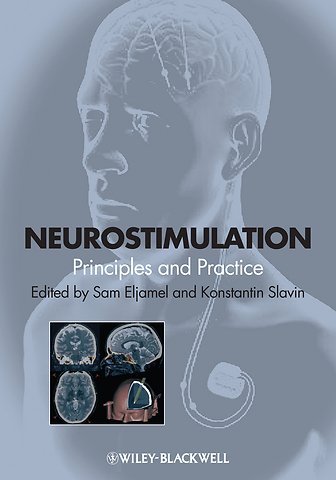 Neurostimulation – Principles and Practice