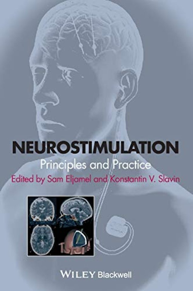Neurostimulation – Principles and Practice