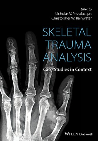 Skeletal Trauma Analysis – Case Studies in Context