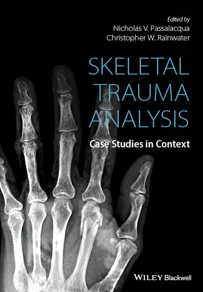 Skeletal Trauma Analysis – Case Studies in Context