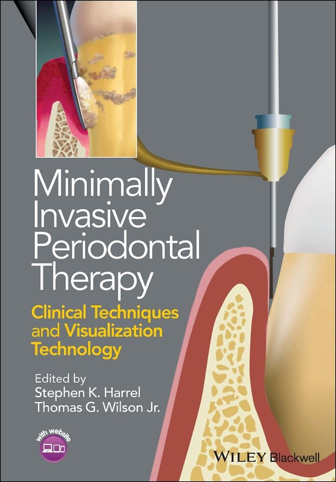 Minimally Invasive Periodontal Therapy