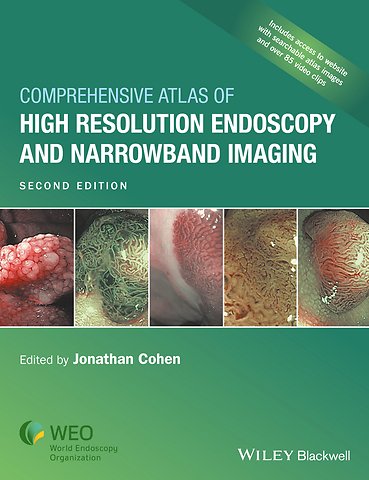 Comprehensive Atlas of High Resolution Endoscopy and Narrowband Imaging, 2nd Edition