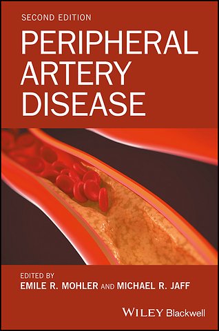 Peripheral Artery Disease Second Edition