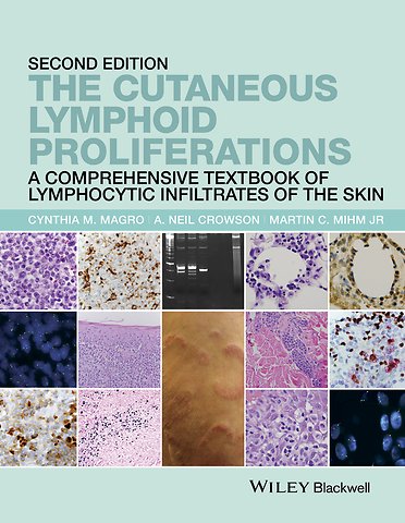 The Cutaneous Lymphoid Proliferations – A Comprehensive Textbook of Lymphocytic Infiltrates of the Skin