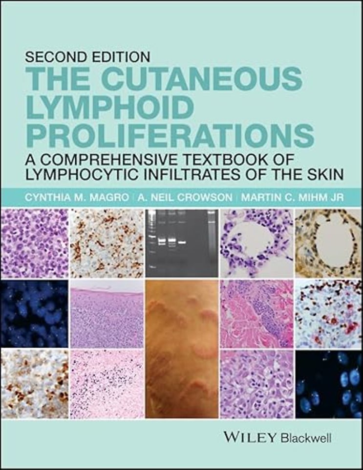 The Cutaneous Lymphoid Proliferations – A Comprehensive Textbook of Lymphocytic Infiltrates of the Skin