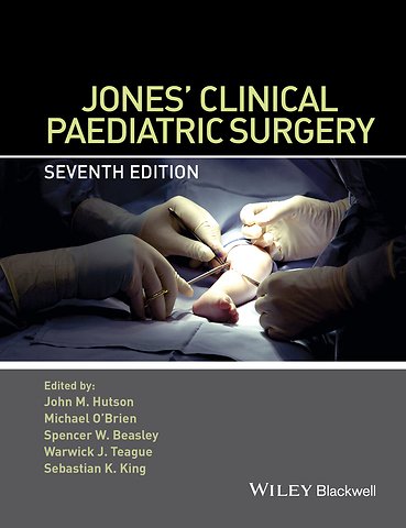 Jones′ Clinical Paediatric Surgery 7e