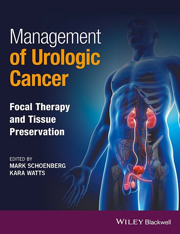 Management of Urologic Cancer
