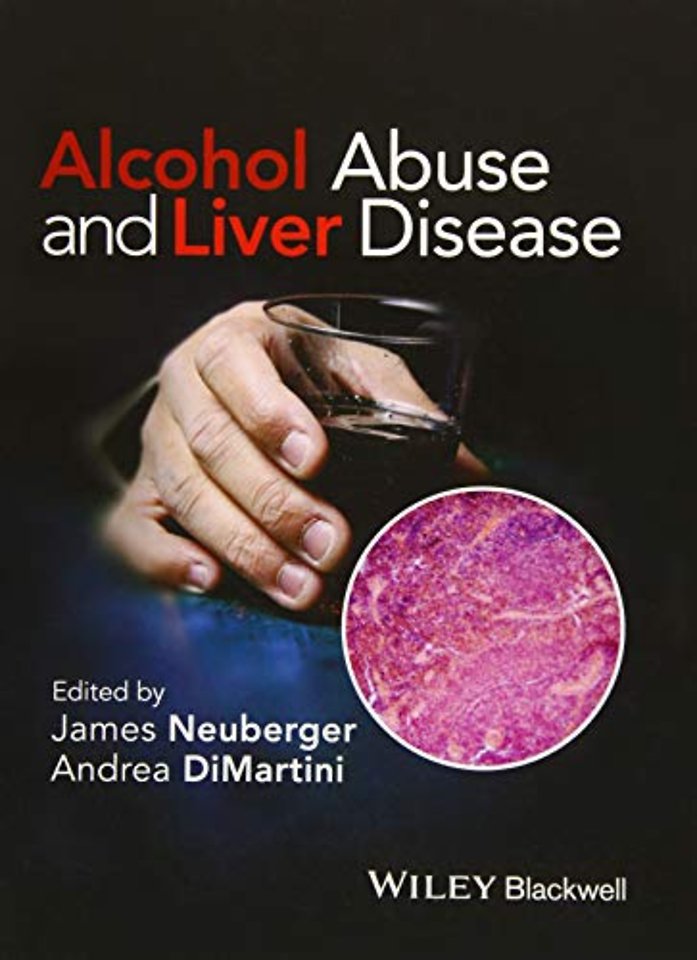 Alcohol Abuse and Liver Disease