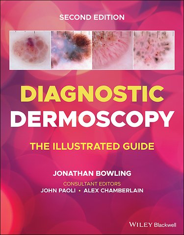 Diagnostic Dermoscopy