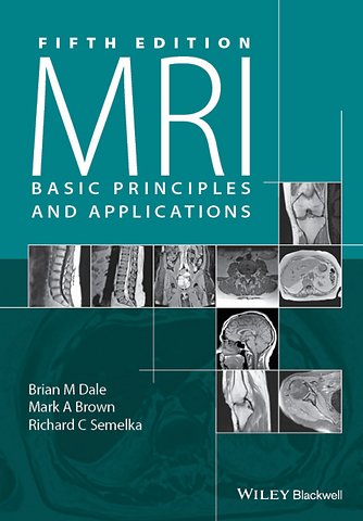MRI Basic Principles and Applications, 5e