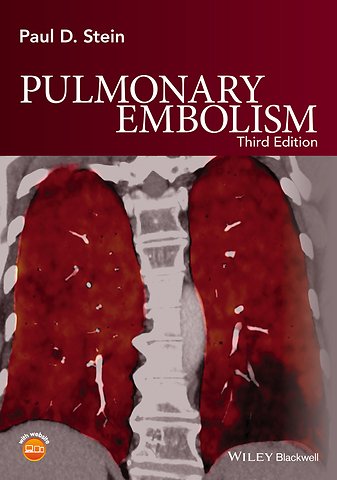 Pulmonary Embolism 3e