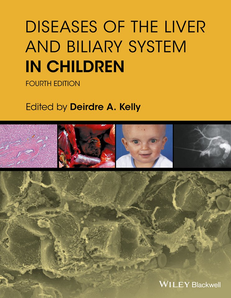 Diseases of the Liver & Biliary System in Children  4e