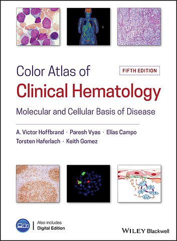 Color Atlas of Clinical Hematology – Molecular and Cellular Basis of Disease