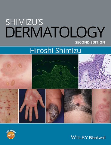 Shimizu′s Dermatology, 2e