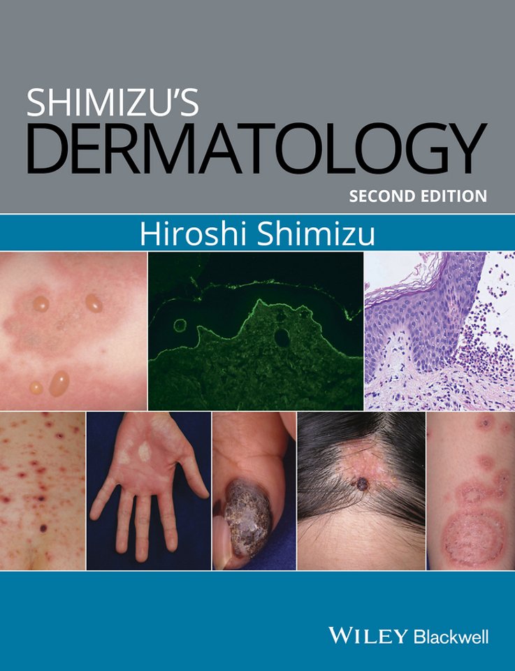 Shimizu′s Dermatology, 2e