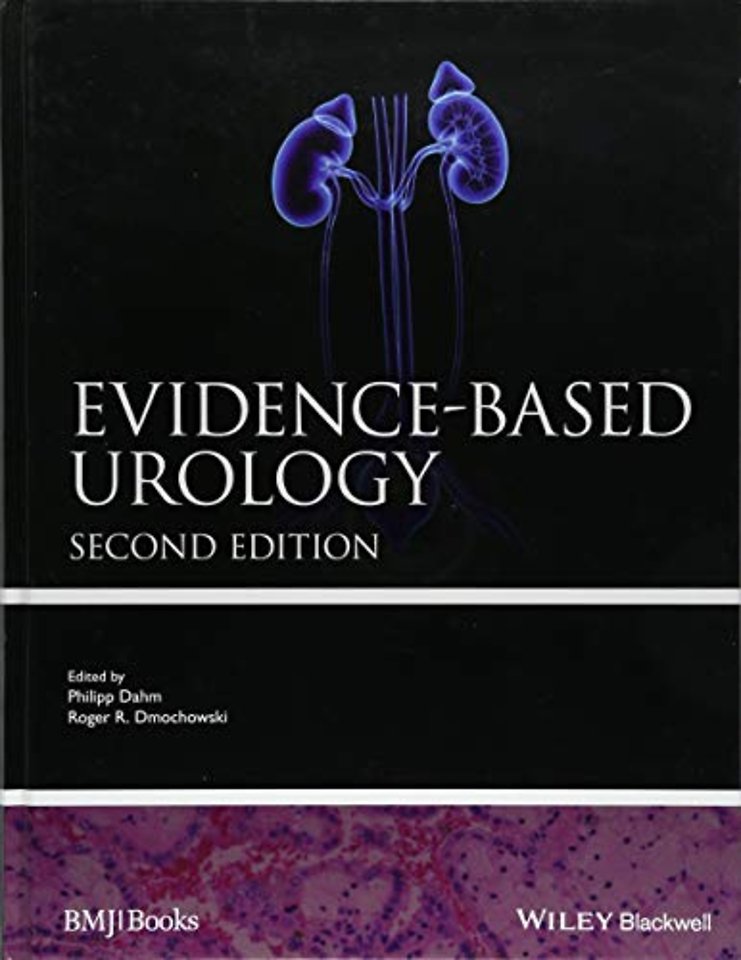 Evidence-based Urology
