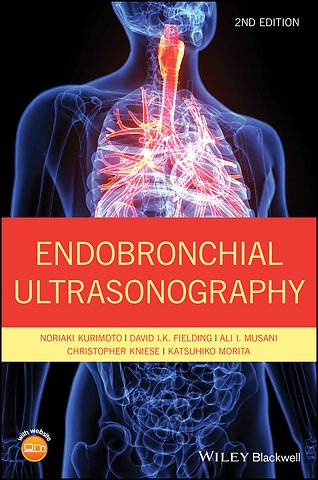 Endobronchial Ultrasonography