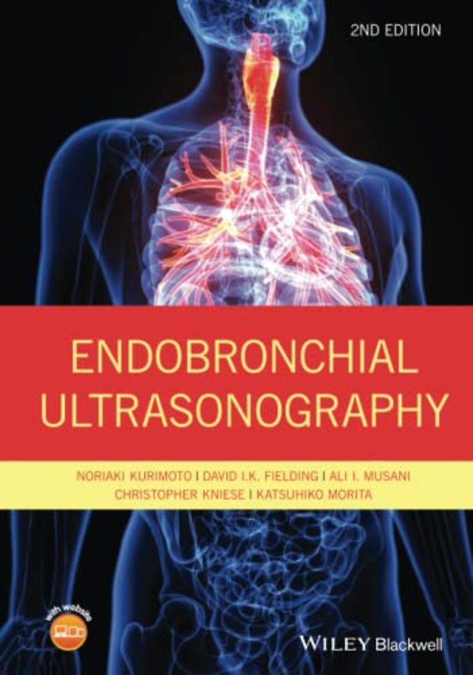 Endobronchial Ultrasonography