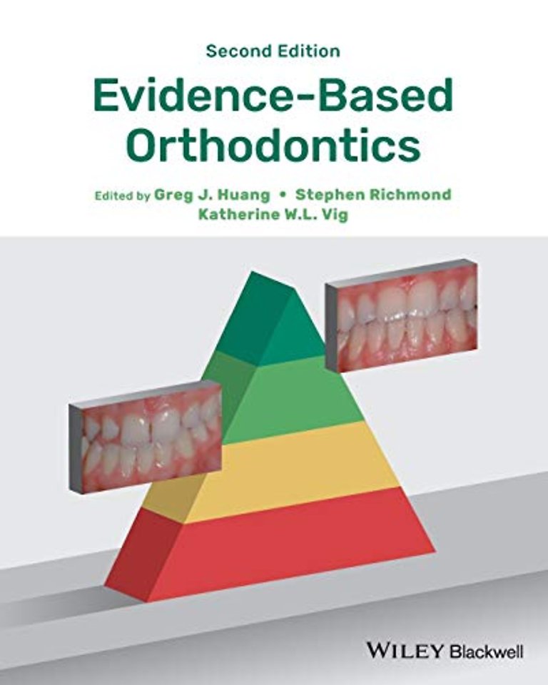 Evidence–Based Orthodontics 2e