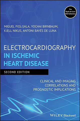 Electrocardiography in Ischemic Heart Disease – Clinical and Imaging Correlations and Prognostic Implications 2e