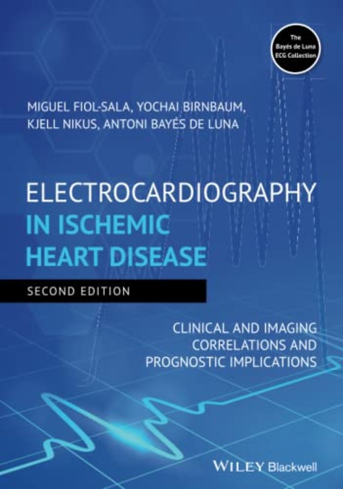 Electrocardiography in Ischemic Heart Disease – Clinical and Imaging Correlations and Prognostic Implications 2e