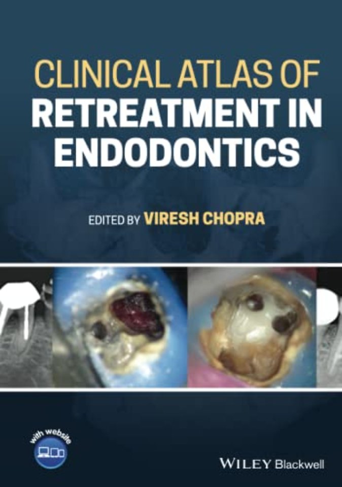 Clinical Atlas of Retreatment in Endodontics