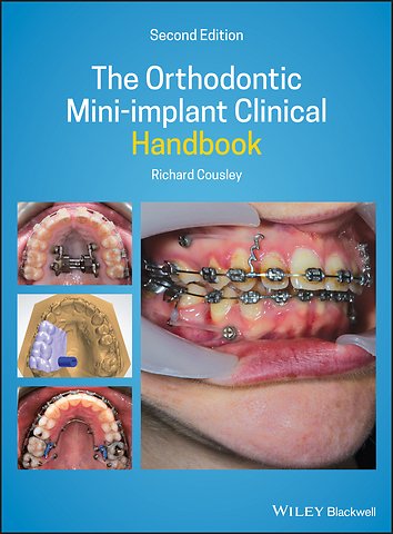 The Orthodontic Mini–implant Clinical Handbook 2nd Edition