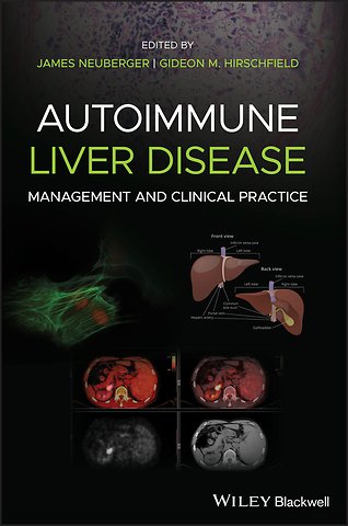 Autoimmune Liver Disease – Management and Clinical Practice