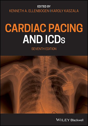 Cardiac Pacing and ICDs 7e