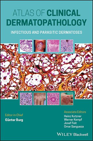 Atlas of Clinical Dermatopathology – Infectious and Parasitic Dermatoses